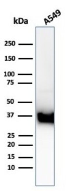 Annexin A1 Antibody (ANXA1/3869R) - Azide and BSA Free, Novus Biologicals